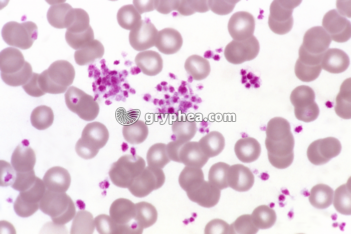 Plaquettes sanguines x340 - gryphea.org